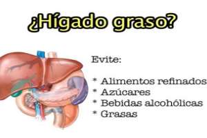 Imagen ilustrativa del artículo Alimentos para Cuidar el Hígado y prevenir el Hígado graso